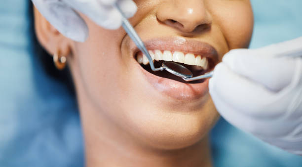 Best Chipped Tooth Repair Near Me  in Vernon, WI